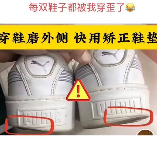 矫正内外八字]成人小腿外翻矫正鞋垫直腿神器鞋跟磨损纠正xo