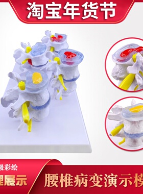 病理腰椎模型人体骨骼模型医院学校用教学演示椎间盘脊椎222913