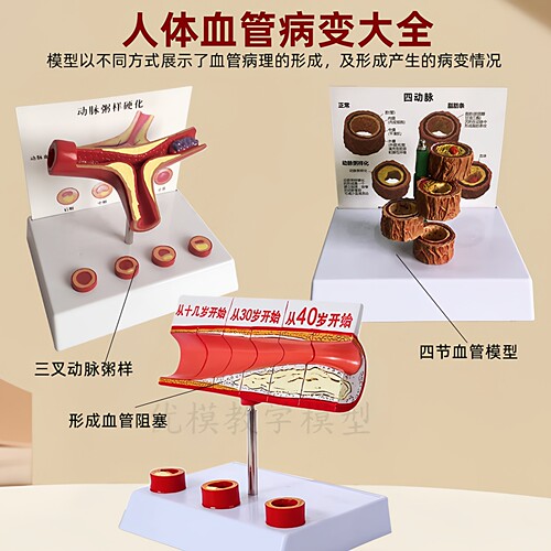 人体血管解剖模型医学教具