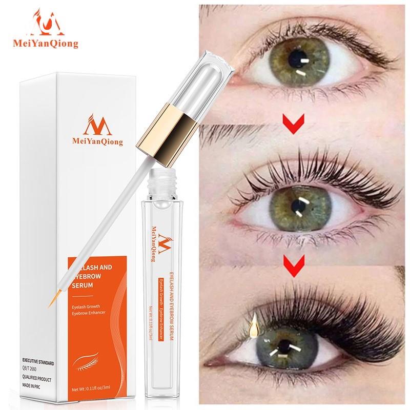 Eyelash Growth Enhancer Natural Medicine Treatments Lash Eye 彩妆/香水/美妆工具 化妆/美容工具 原图主图