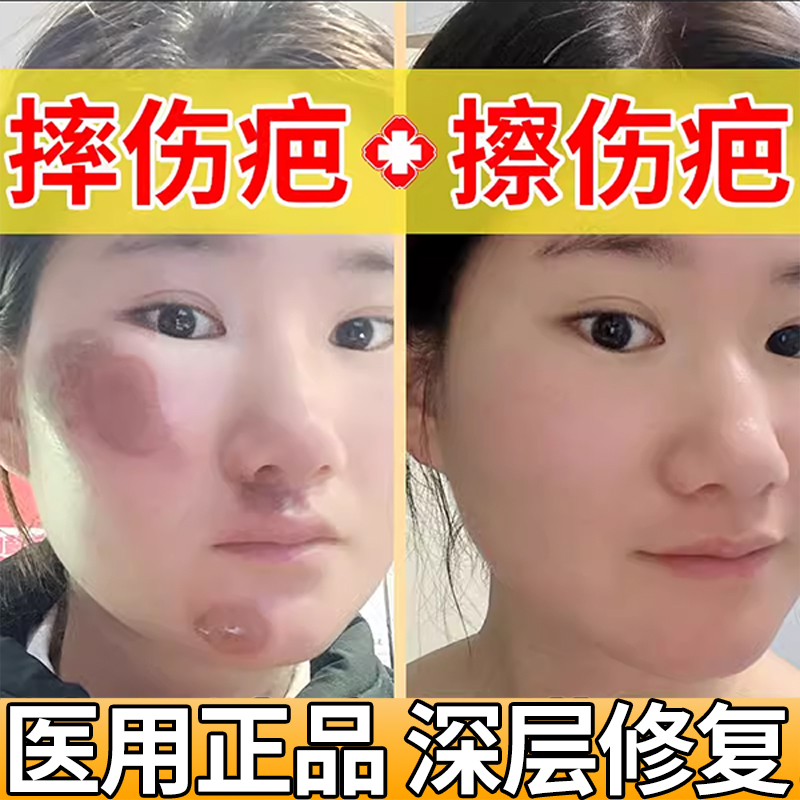 祛疤印淡化黑色素疤痕增生凸起非去除疙瘩妊娠纹修复疤痕凝胶膏zy