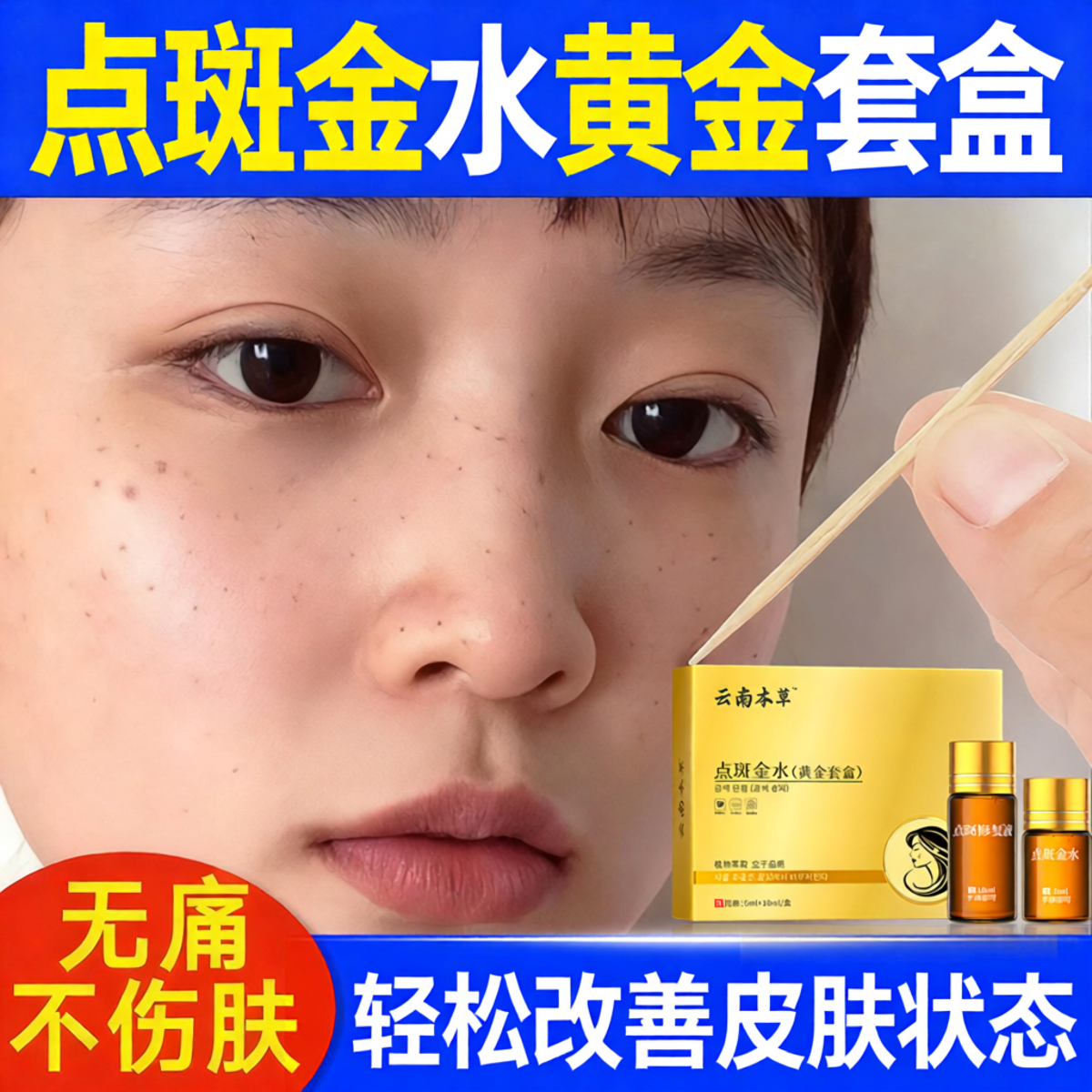 点斑药水不留疤正品旗舰店无痕遗传脸黄分解雀褐斑黑色素美容院yq