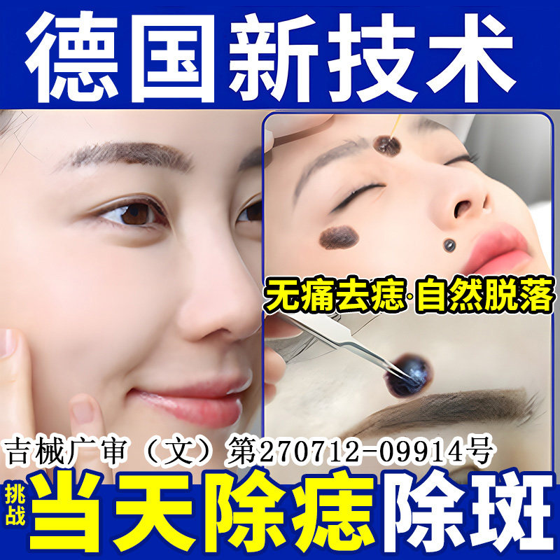去痣点痣膏水不无痕净雀斑痦子美容院专用不留疤正品医用级旗舰店