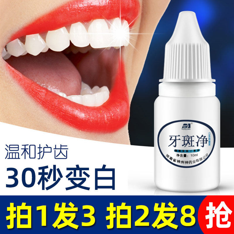 牙结石溶解牙石速效牙黄洗白去牙渍牙垢黄牙美白牙齿牙斑净去渍