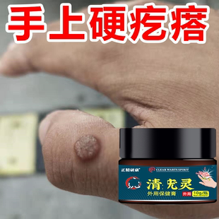 正精研康去肉粒神器去除刺一抹疙瘩手上脚上去除外用草本