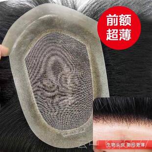 正品前额隐形生物头皮递全针痕假发 男士无发地中海头顶真仿真补