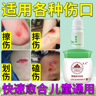 擦伤药膏儿童摔伤破皮药脸上膝盖磕伤外伤伤口快速愈合膏