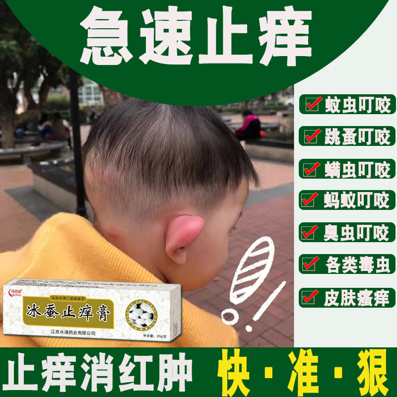 蠓虫跳蚤咬祛叮包止痒消红肿儿童止痒药膏蚊子叮咬过敏冰蚕止痒膏