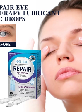 Eye Drops Relieve Eye Fatigue Dryness Blurring Gentle Moistu