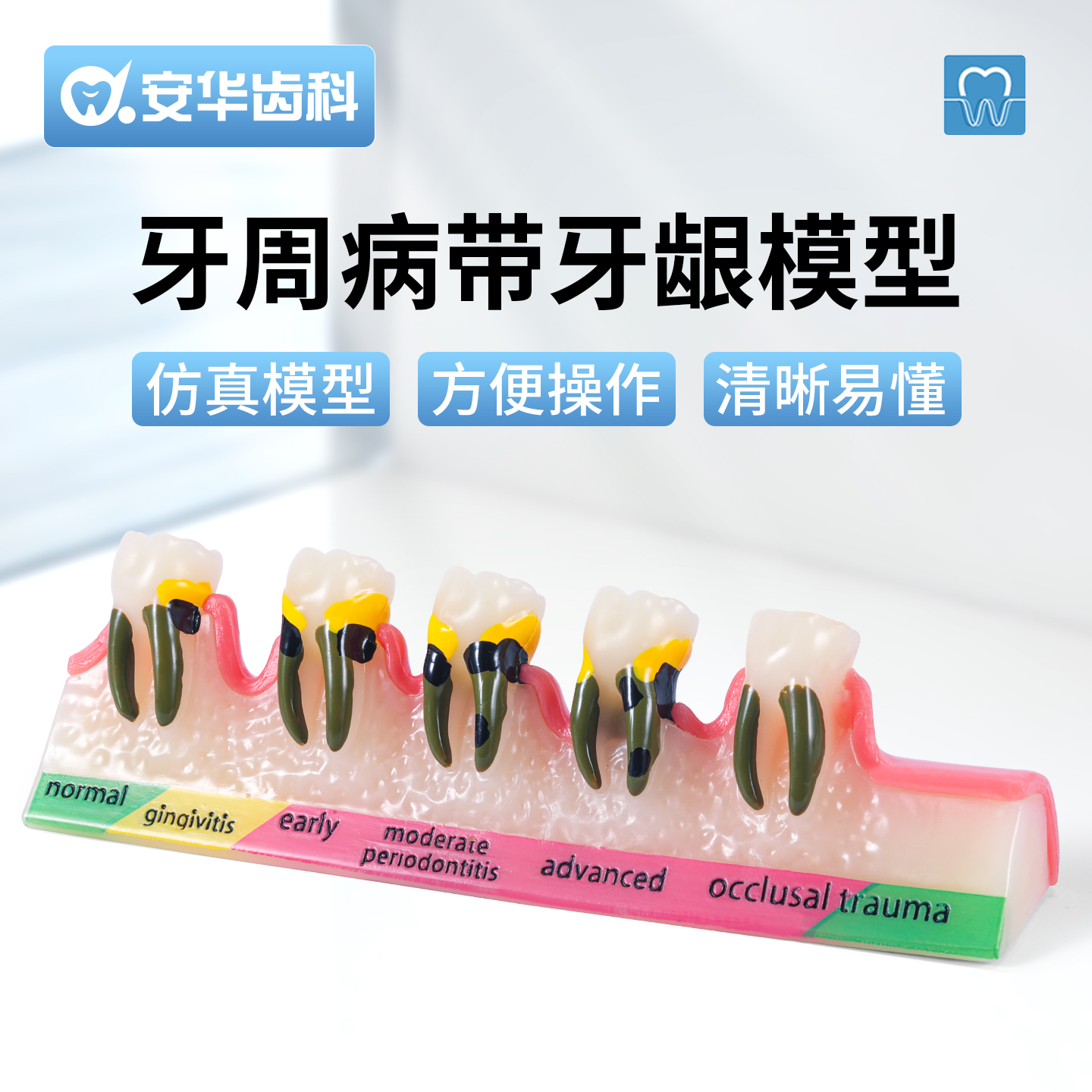 牙科牙周病带牙龈模型口腔龋齿
