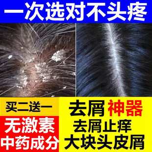 大块头皮屑神器去头头屑除头螨去屑止痒洗发水控油伊芙特抑菌洗液