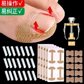 甲沟矫正器贴片炎嵌甲神器防止脚趾甲往肉里长专用隔离填充垫工具