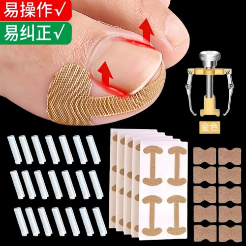 甲沟矫正器贴片炎嵌甲神器防止脚趾甲往肉里长专用隔离填充垫工具