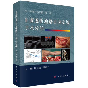 血液透析通路百例实战 手术册 谭正力主编 科学出版社