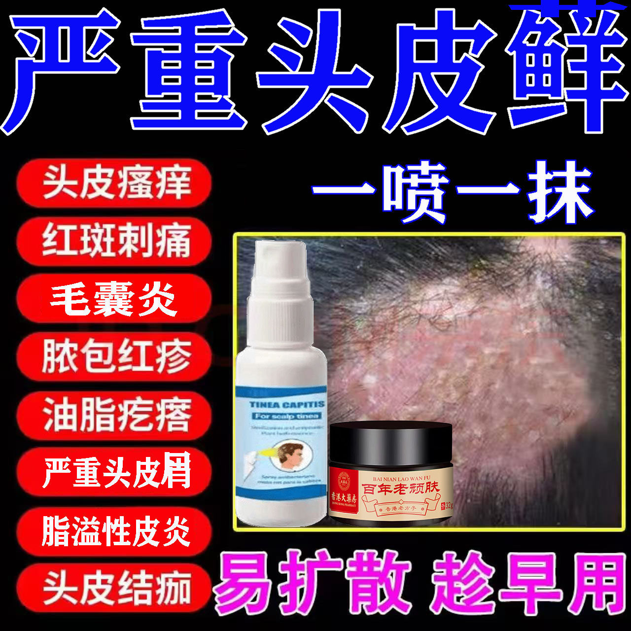 治头皮屑藓脂溢性皮炎痒去头部痒毛囊炎病真菌肤专用膏喷剂止药