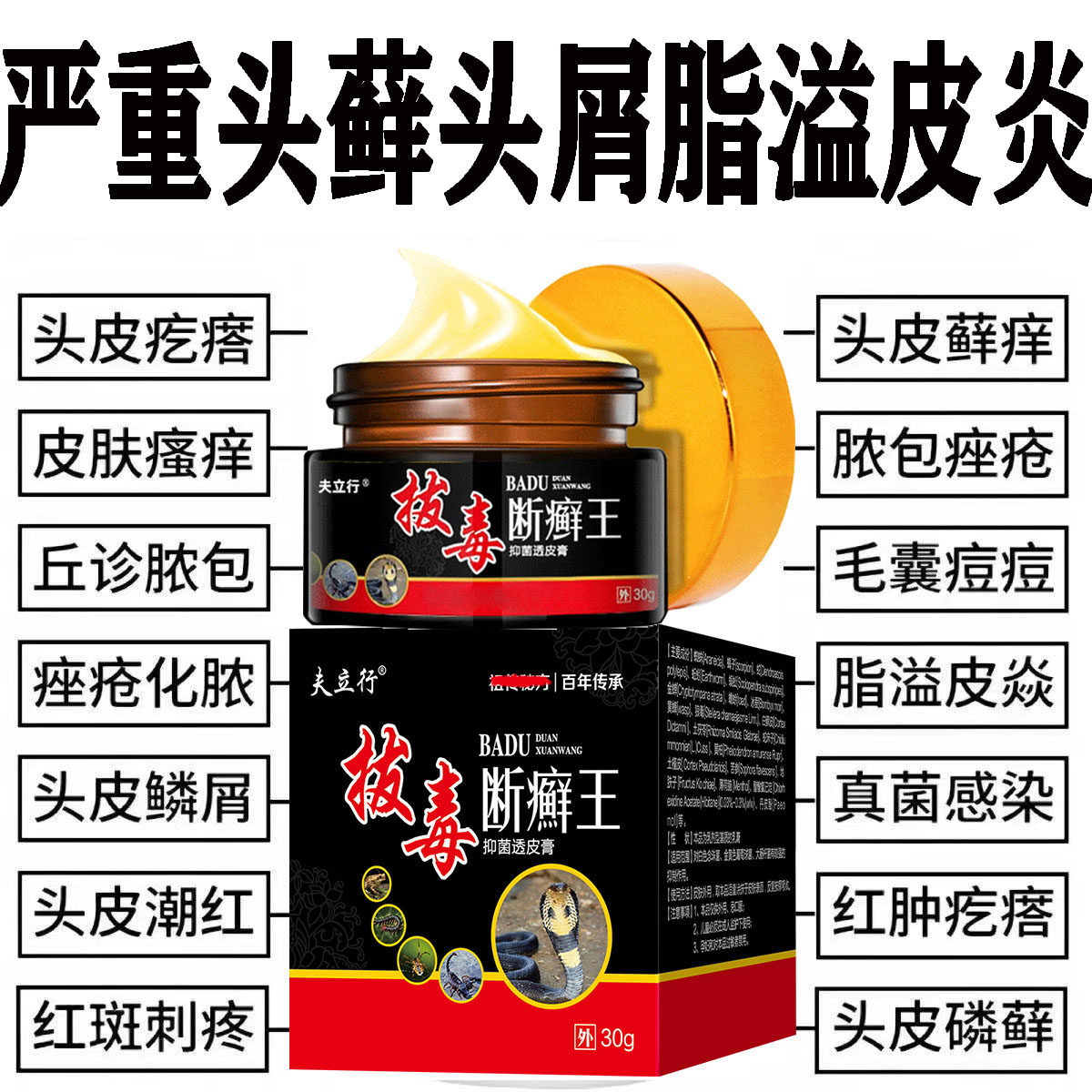 治头皮屑藓脂溢性皮炎牛皮银药去头部痒毛囊炎膏病真菌感染专用屑