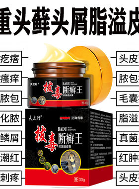 【老方子包冶好】头皮藓膏