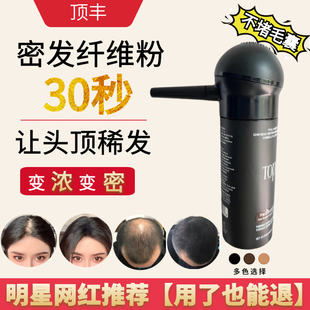 toppik增发纤维粉密发顶丰头发纤维粉补发美发际线喷雾男女通用