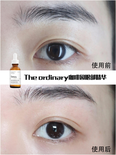 加拿大the ordinary咖啡因眼部精华改善眼袋紧致水肿淡化黑眼圈