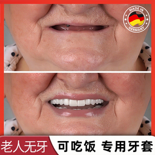 假牙齿塞牙缝防塞遮丑义齿美白假牙全口老年人牙套通用吃饭神器x