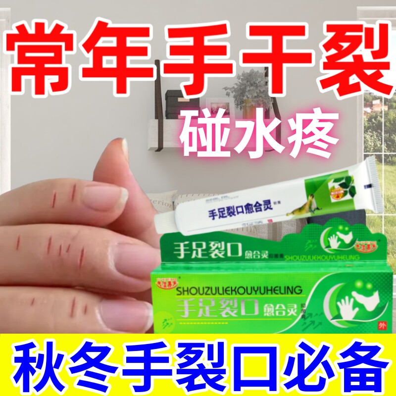 手裂口药膏手指严重裂口指甲缝裂口脚后干裂防皲裂开裂愈合修复霜