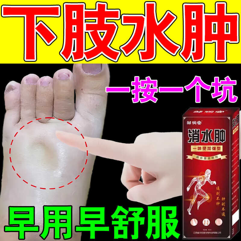 消水肿喷剂腿脚水肿下肢水肿中老人脚肿四肢水肿脚背水肿走路困难