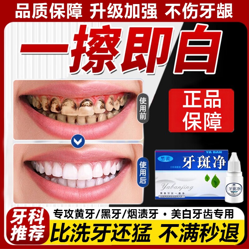 【商超爆卖款】牙白人更美 牙齿去黄去结石烟渍茶渍男女通用神器