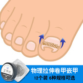 正甲丝正甲贴甲沟嵌甲炎专用拉拉脚趾甲指甲纠矫正器贴贴片长肉里
