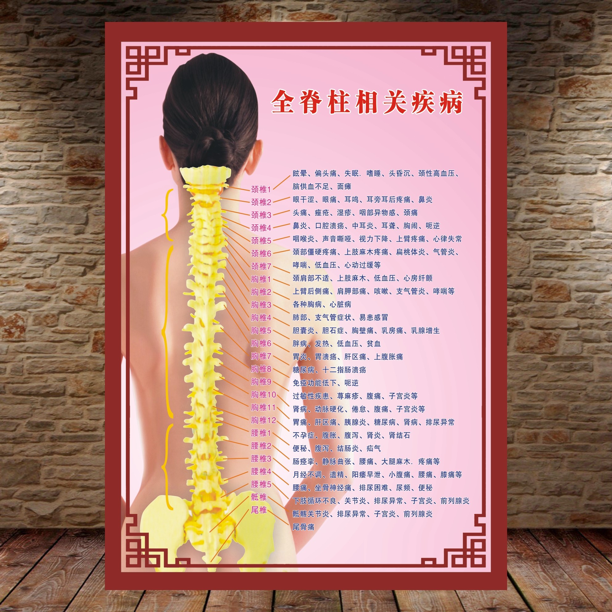 中医 女性全脊柱相关疾病示意图养生病理原因结构图挂图海报