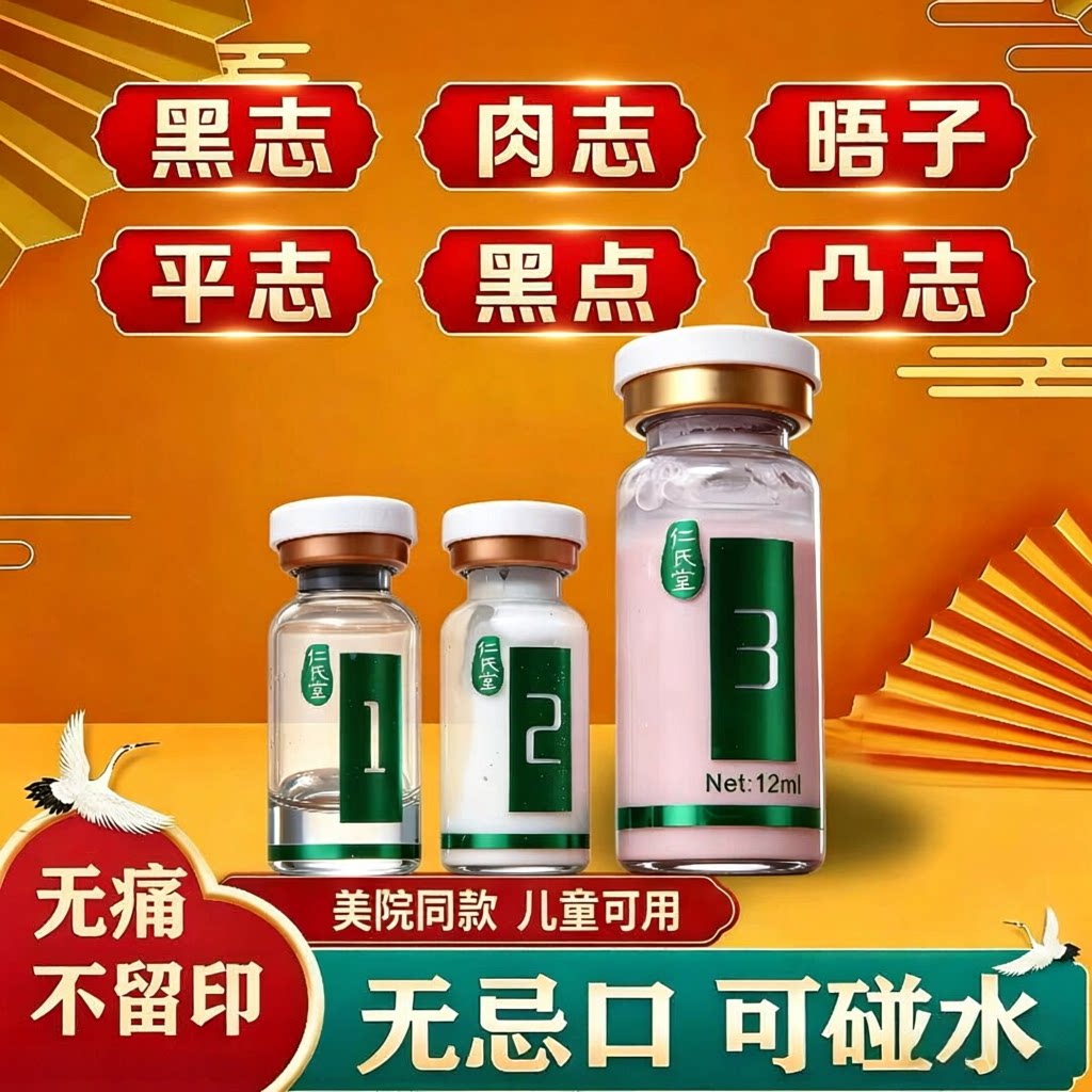 点痣膏点痣无痕不留疤旗舰店正品