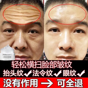面霜保湿搭抬头纹祛去除男士消除皱纹神器抗皱提拉紧致额头抗衰老