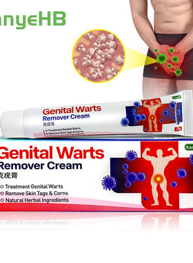 Genital Warts Remover Cream 平猴尤祛疣膏Wish Ebay Lazada 20g