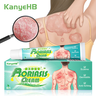 KanyeHB 癣膏皮肤外用膏藓膏20g Wish 跨境热销 Joom Ebay Lazada