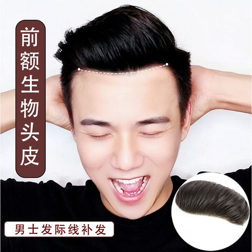 假发片男士前额发际线贴真人发全手织生物头皮隐形发块刘海补发片