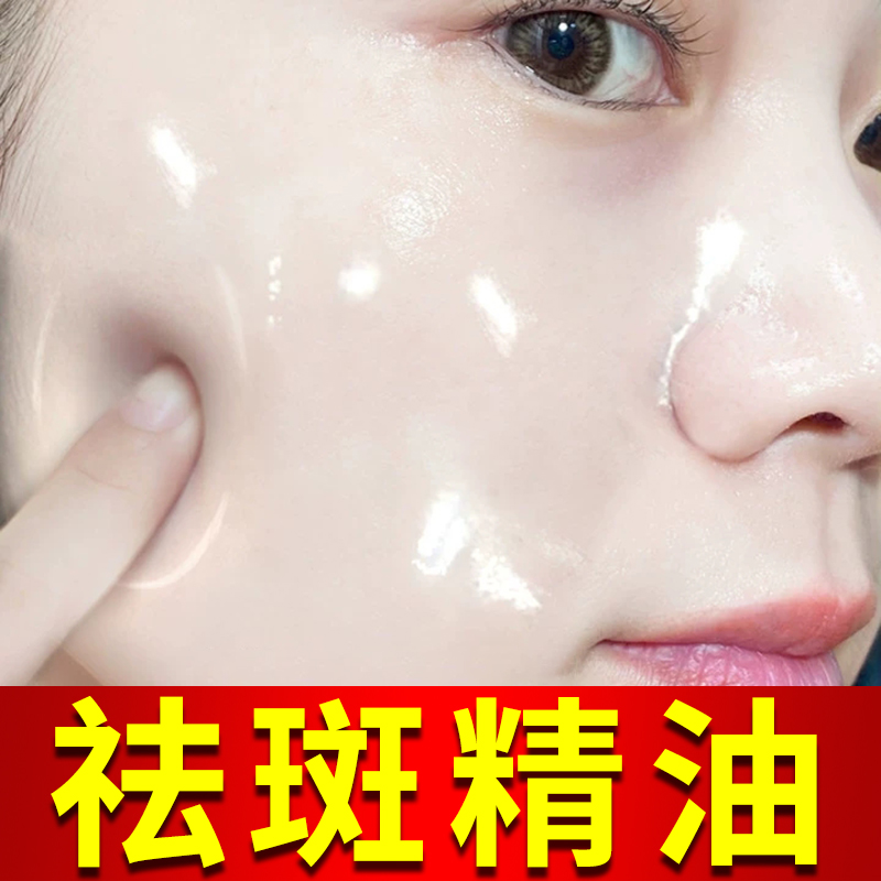 玫瑰精油官方旗舰店正品脸部美白祛斑淡化黑色素改善暗沉面部暗黄