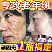 日本祛斑霜进口成分老年斑强力去除祛黄褐斑雀斑美白精华官方正品