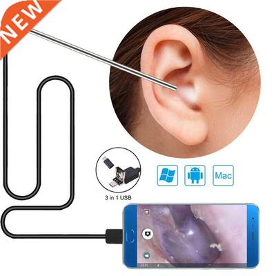 in 1 Ear Wax Removal To,USB Otoscope-Ear Scope Camera In