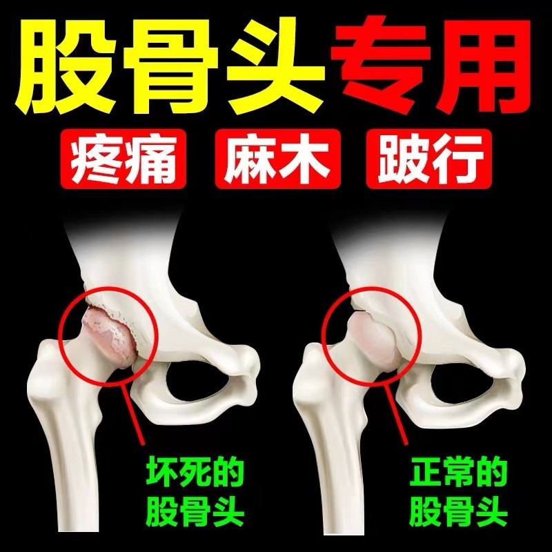 药房直发股骨头坏死消痛冷敷贴