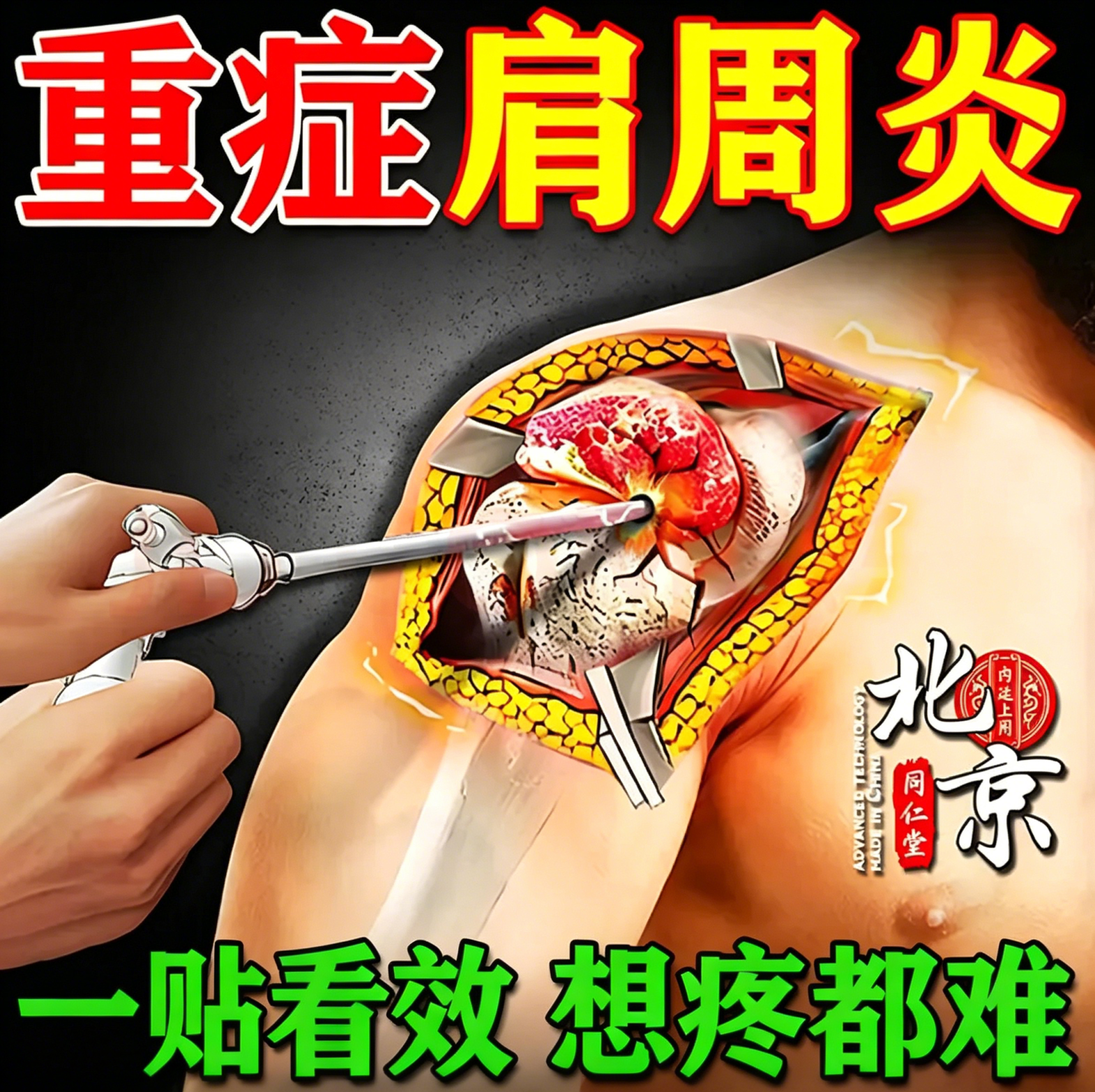 【精准止痛】给肩周加满油