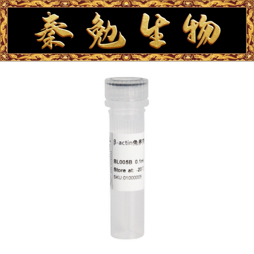 Anti-β-ActinRabbitPolyclonal