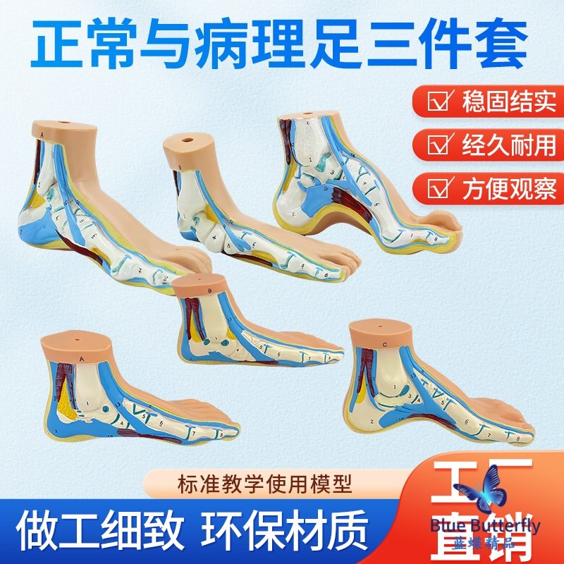 老款足部模型 人体脚掌肌肉弓形脚掌模型 脚解剖模型平板足正常足,玩具/童车/益智/积木/模型,其他模型玩具,淘宝优惠券,粉丝福利购,淘宝优惠卷