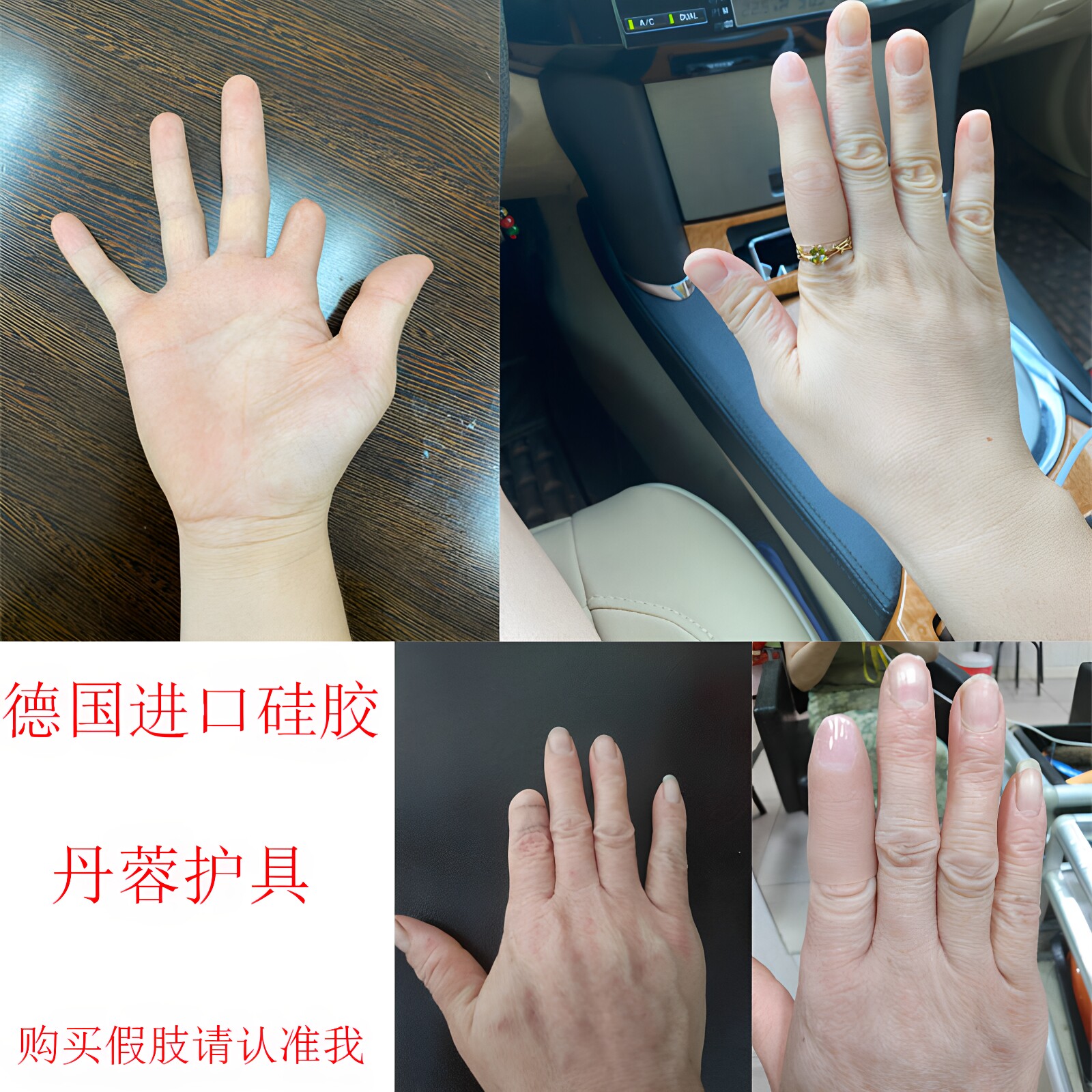 假肢假手指仿真脚趾残疾人义肢半指德国进口硅胶美容手套量身定做