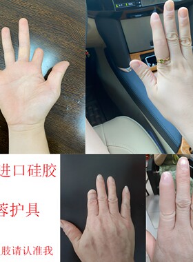 丹蓉通用上海手指假肢硅胶义肢