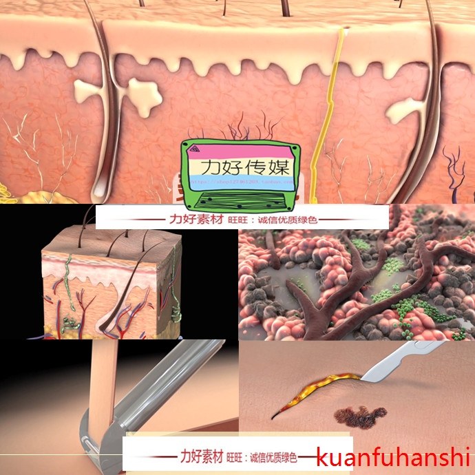 皮肤 3D 三维动画 医疗 医学 皮下组织 皮肤三维动画视频素材