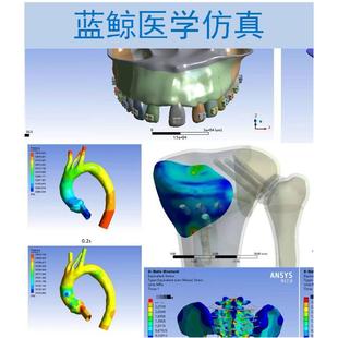 医学有限元分析ansys/abaqus/fluent骨关节口腔心血管