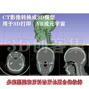 医学CT影像核磁共振3D建模DICOM转3D打印格式stl牙科骨科三维重建
