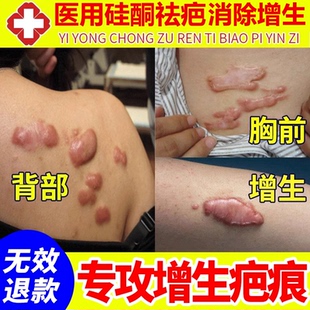 祛疤膏疤痕增生凸起去除疙瘩瘢痕胸前性修复疤膏去疤痕凝胶软化针