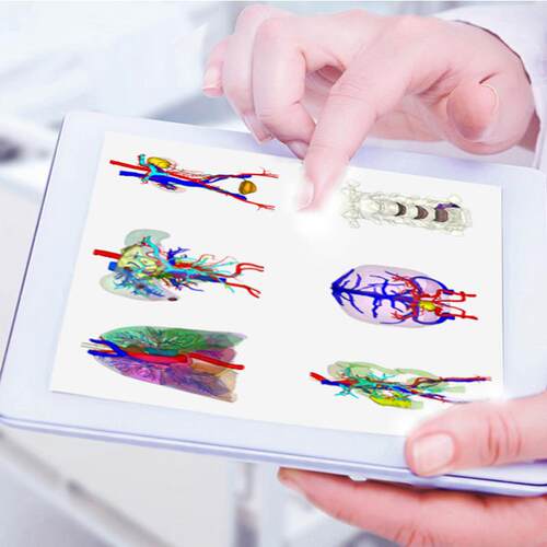 itk snap 3D Slicer NII CT医学影像 DCM STL roi 三维重建 标注