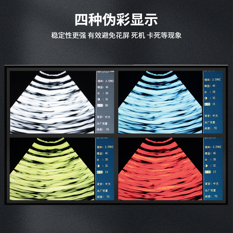 兽用B超机高清母猪测孕仪器牛羊用b超畜牧彩超机便携超声波比超机,五金/工具,水表,淘宝优惠券,粉丝福利购,淘宝优惠卷