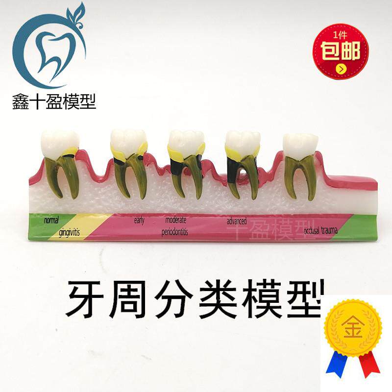 牙科材料b龋齿演变模型牙周分解教学讲解沟通饰品
